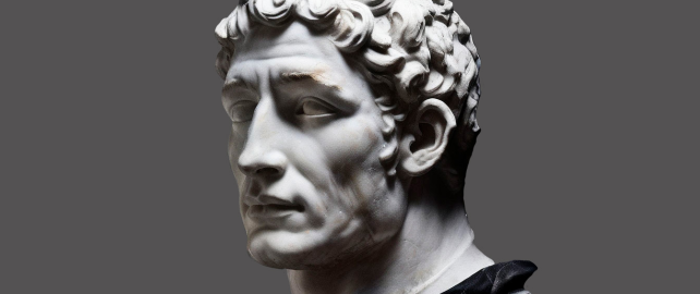 Восстановление объемных дефектов нижней челюсти с помощью индивидуально изготовленного титанового имплантата